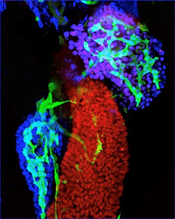 Jagged Notch Signaling | Alagille Syndrome 3